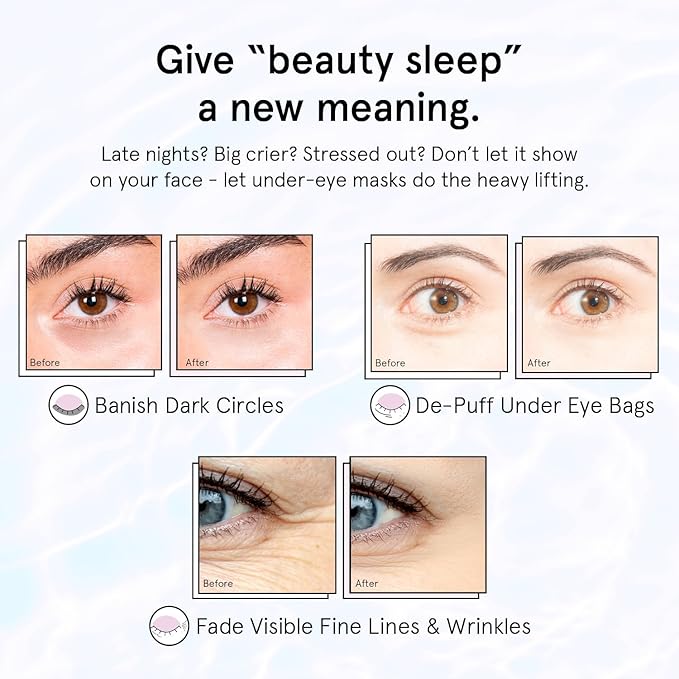 grace & stella Retinol Under Eye Patches for Puffy Eyes and Dark Circles - Restoring Gel Under Eye Masks with Hyaluronic Acid - Vegan Cruelty-Free Skincare, Birthday Gifts for Women (Purple, 48 Pairs)
